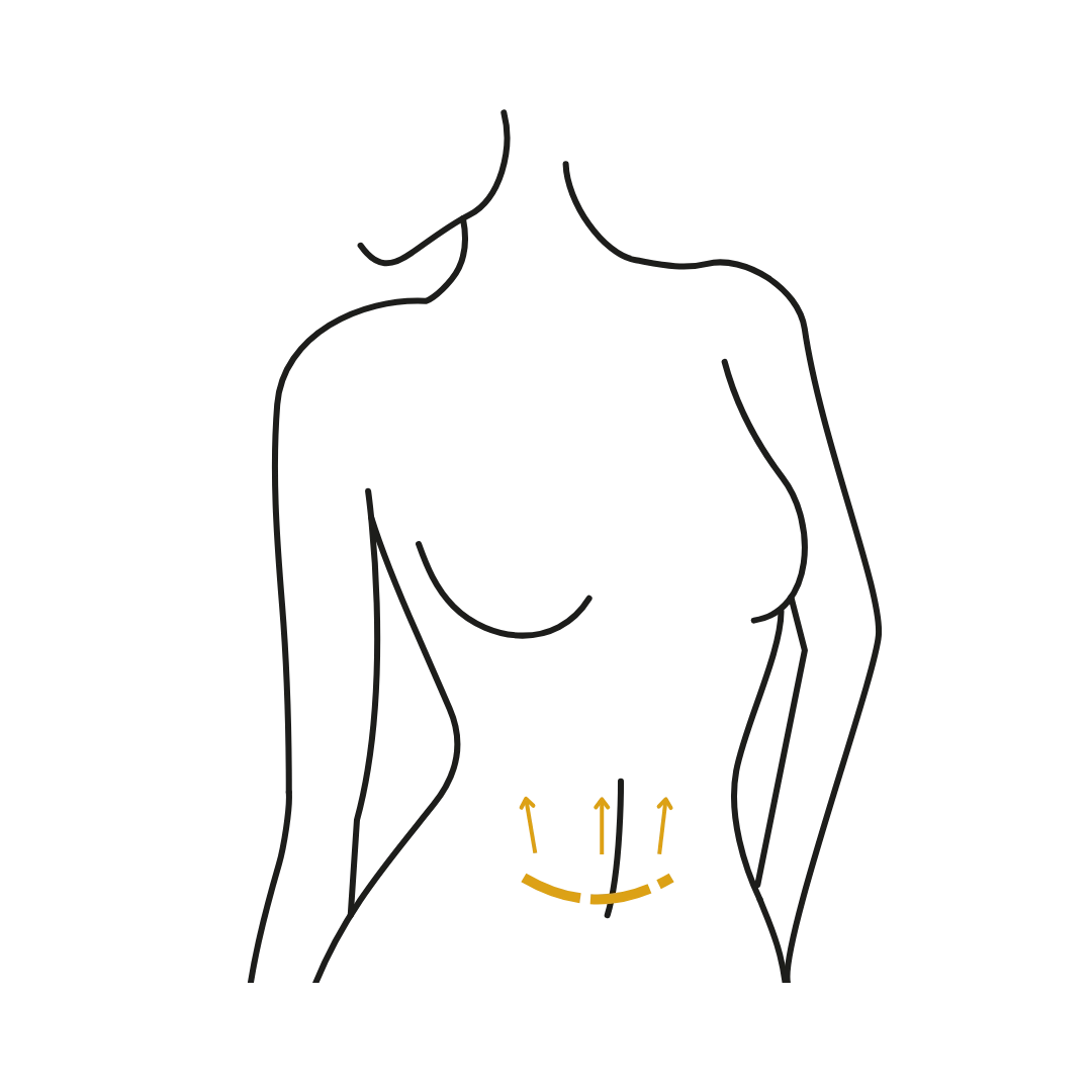 Woman's body illustration highlighting the location of the Tummy Tuck Surgery